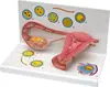 Human fertilization and development process of amphicytula model