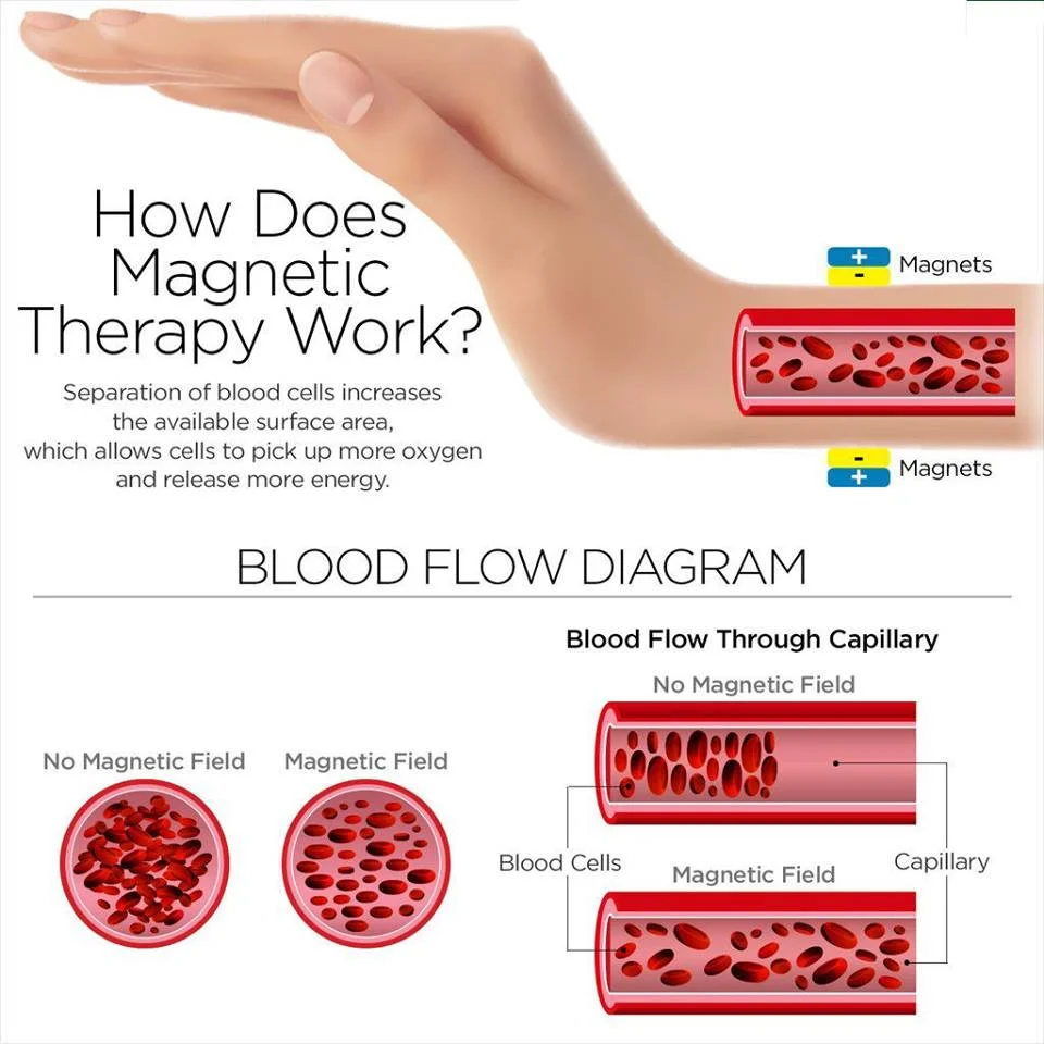 magnetic therapy