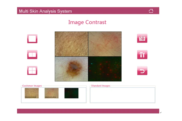 skin analyzer2 (7).png