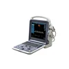 New coming product! Cheapest Full Digital Color Doppler Diagnostic Ultrasound machine for sale