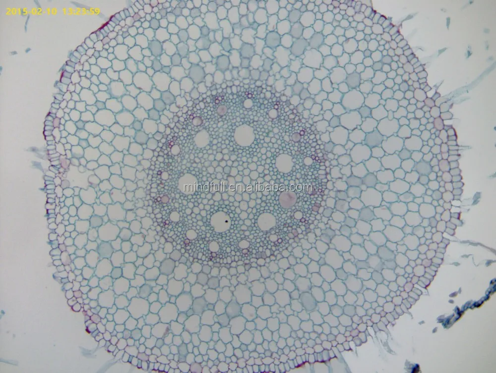 2_Monocot_root(zea_mays).jpg