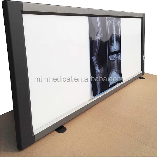 High quality LED X-ray viewer box for medical use, made in China