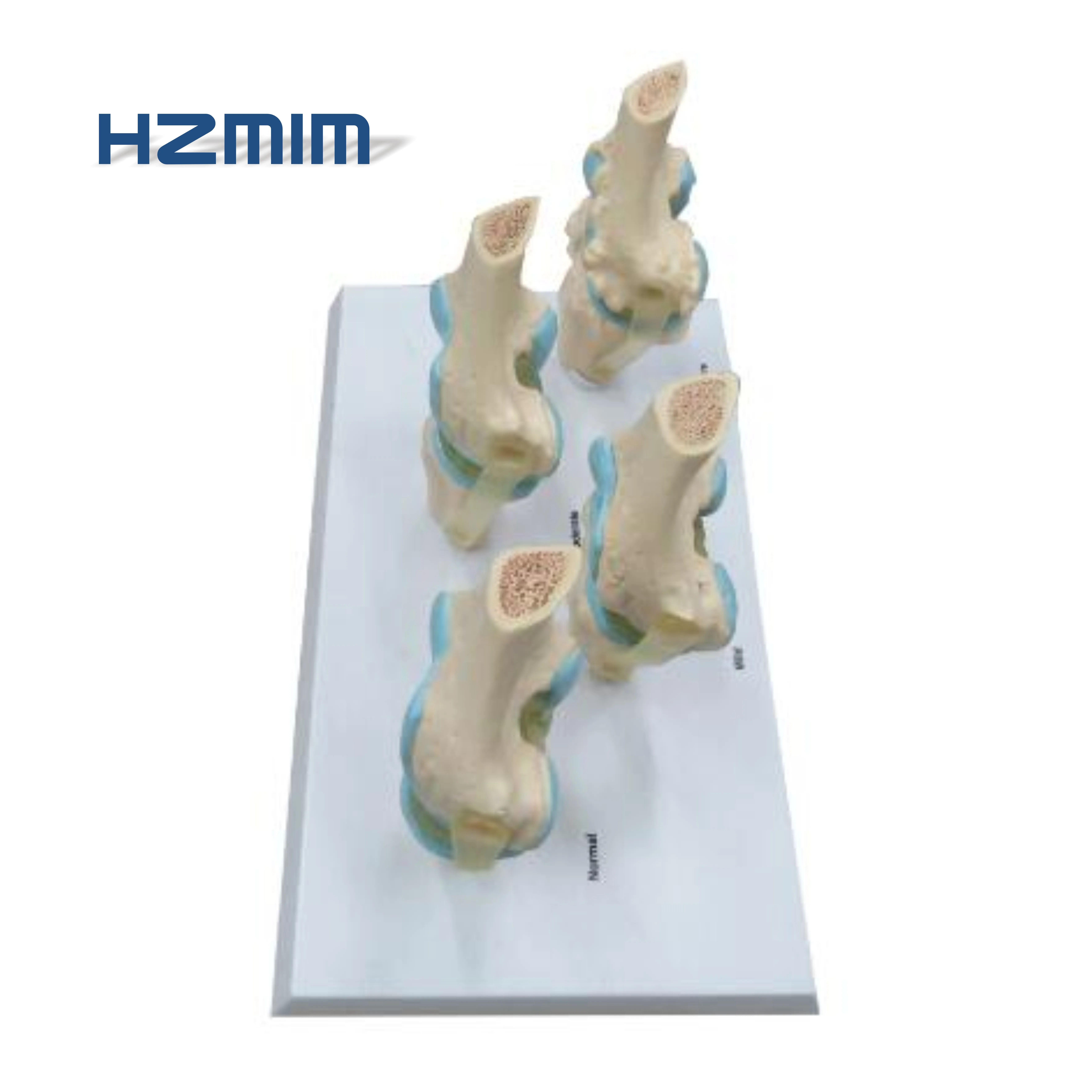 knee joint.jpg