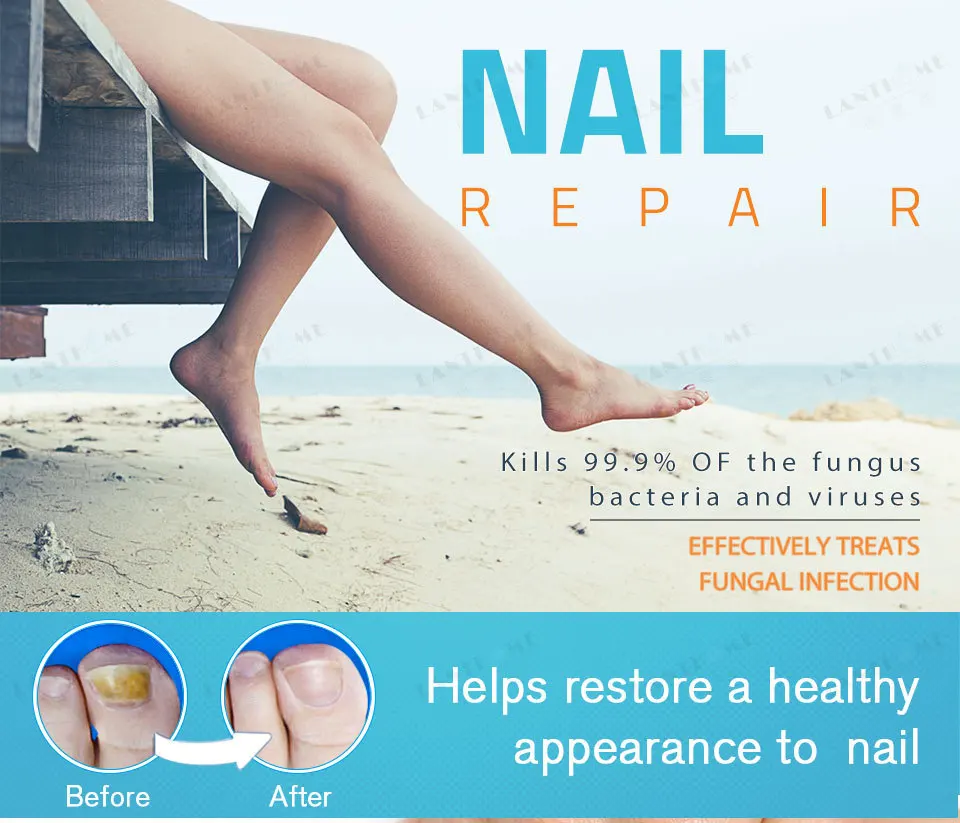 LANTHOME Natural Nail Care Oil Anti Fungus Nail Treatment Nourishing Repair Nail Serum Pen