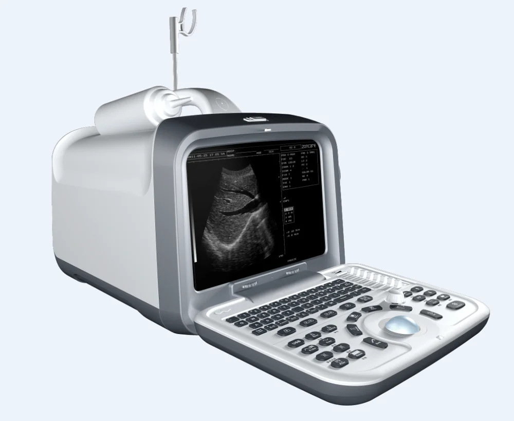 Portable Devices Micro-convex Ultrasonic Scanner Ultrasonic Diagnostic Scanner