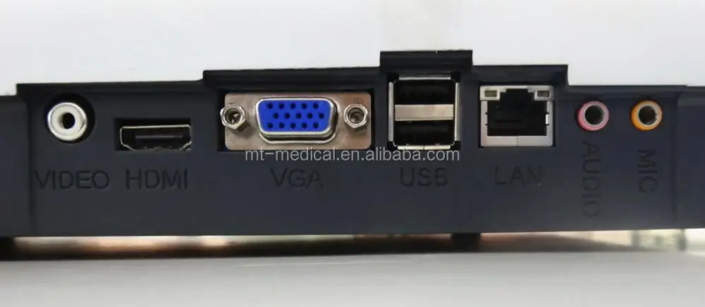 USB Ultrasound Scanner Medical Ultrasound Diagnostic System Price