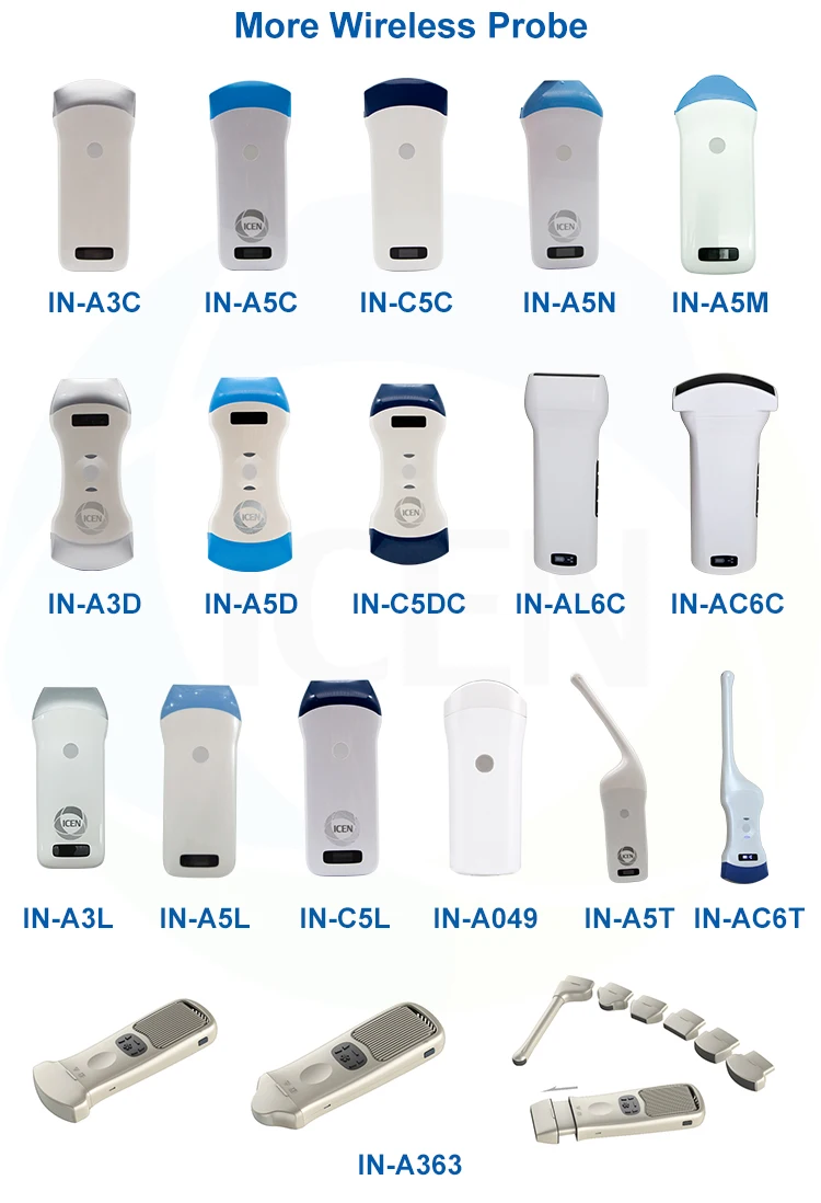 mobile phone ultrasound scanner