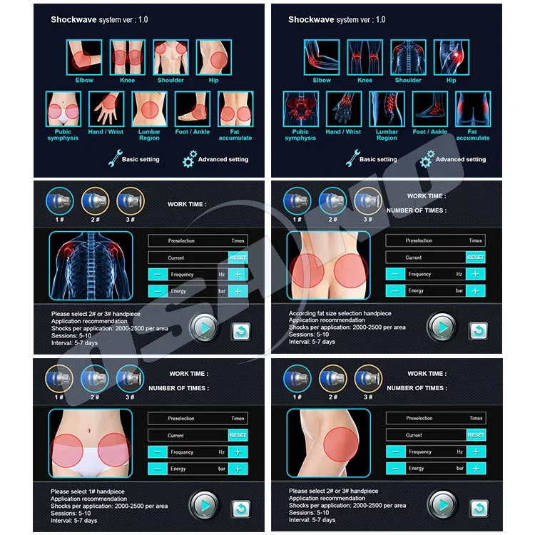 shockwave therapy for penis