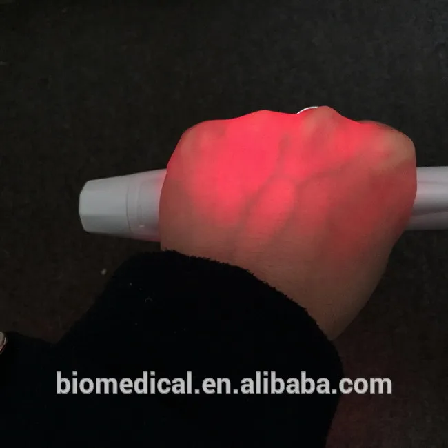 Palm vein scanner