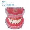 New Arrival Dental Model with Soft Gum and Removable Teeth for Tooth Practice Extraction