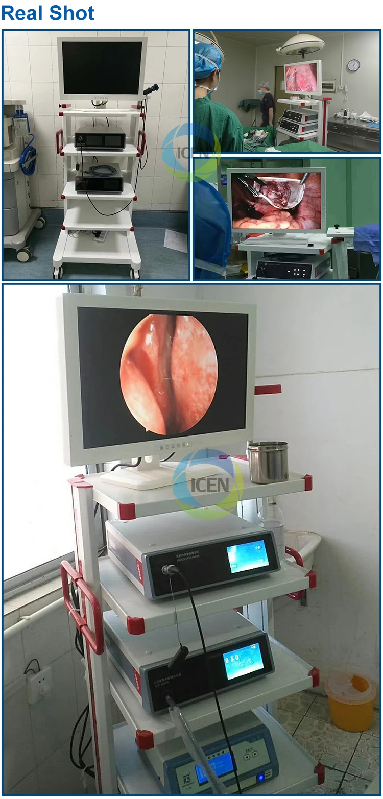 laparoscopy camera system