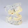 Dental Supply pathological model/Dental model of standard adult pathological
