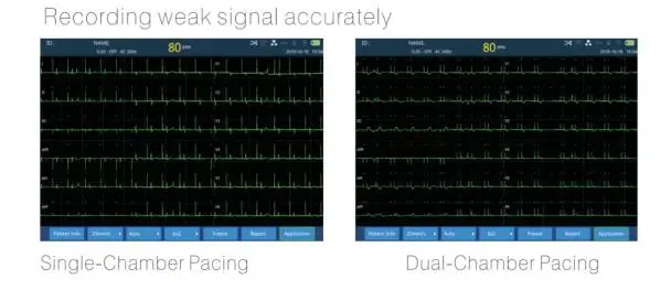 Portable 12 Channel ECG machines mac compatible