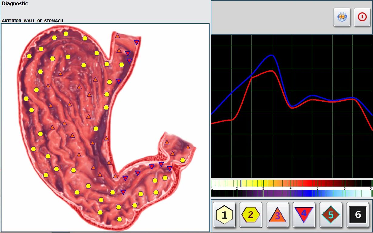 2021 Latest Professional 2 in 1 Touch Screen Metatron NLS Metapathia GR Hunter 4025