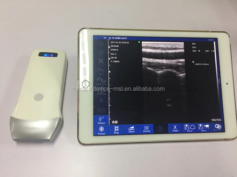 Compatible Phone Ultrasound Machine Linear Probe/pocket Usg Linear Ultrasound Transducer 7.5mhz