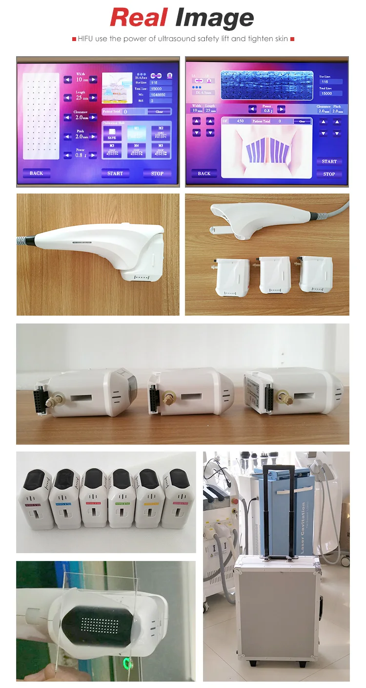 OEM-3D-HIFU_08.jpg