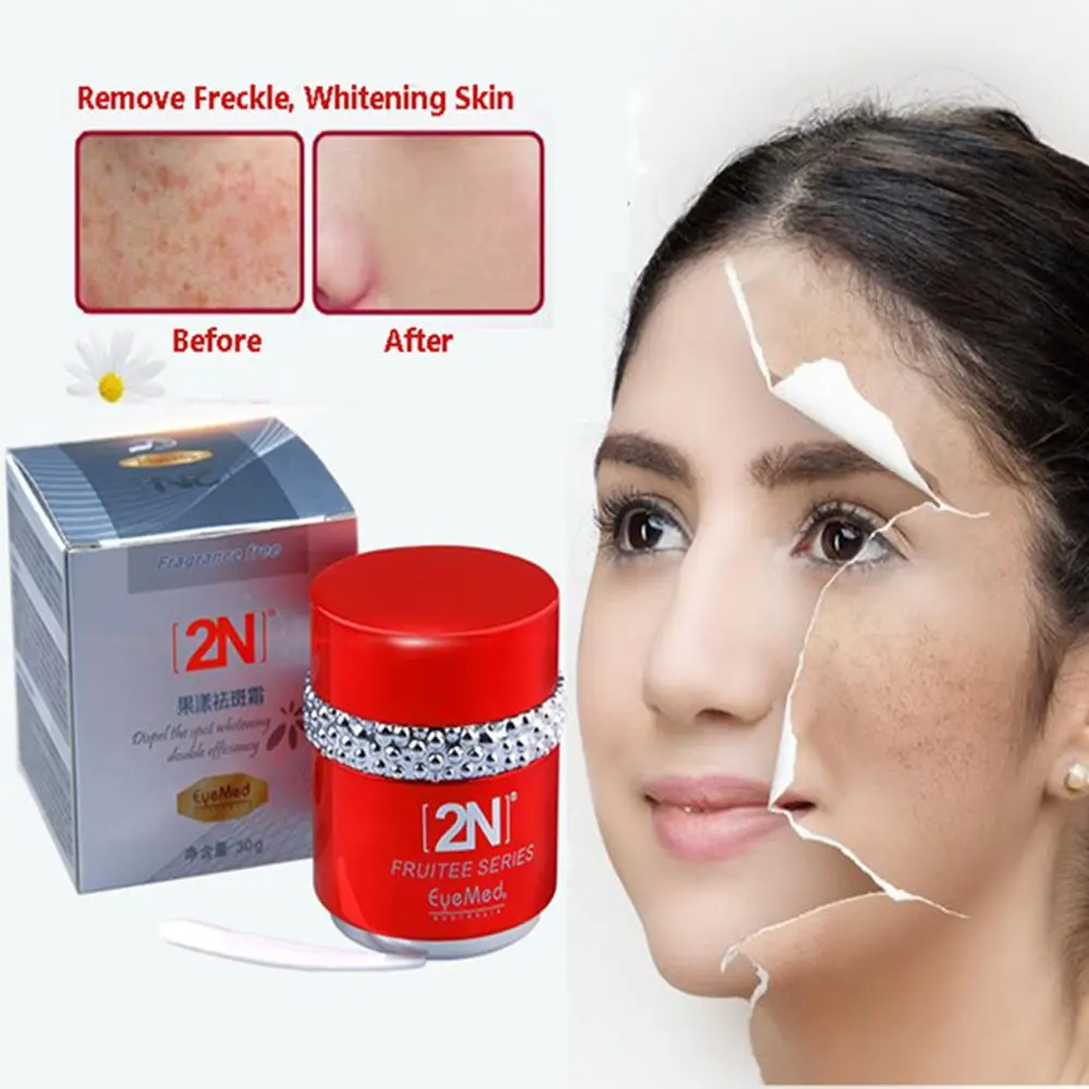 fade cream for face