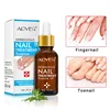 Nail Repair Essence Serum Fungal Nail Treatment Remove Onychomycosis Hands and Feet Care of Toe Nail Nourishing Brighte