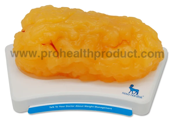 PH03-043 Soft 5lbs TPR Anatomical Fat Model