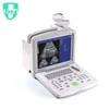 FY-160 PC Based 12" Inch LCD Screen Full Digital Black & White Ultrasound Scanner China Supplier