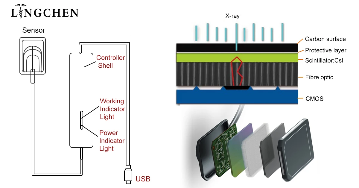 supply digital dental x ray sensor price