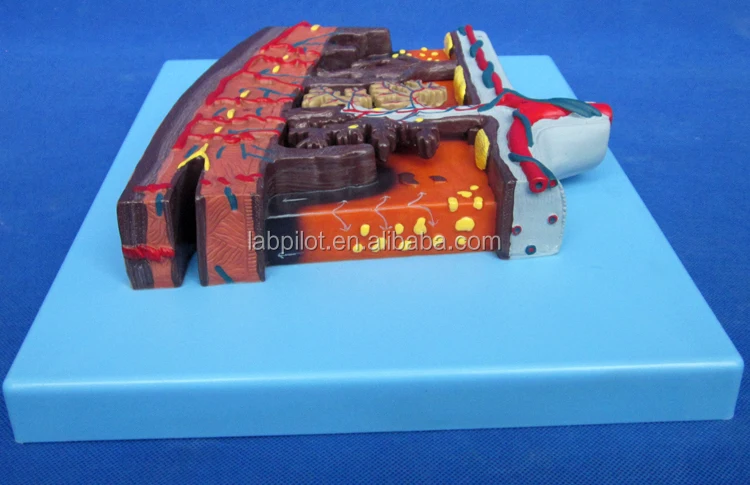 A42010-2 placenta (9).jpg