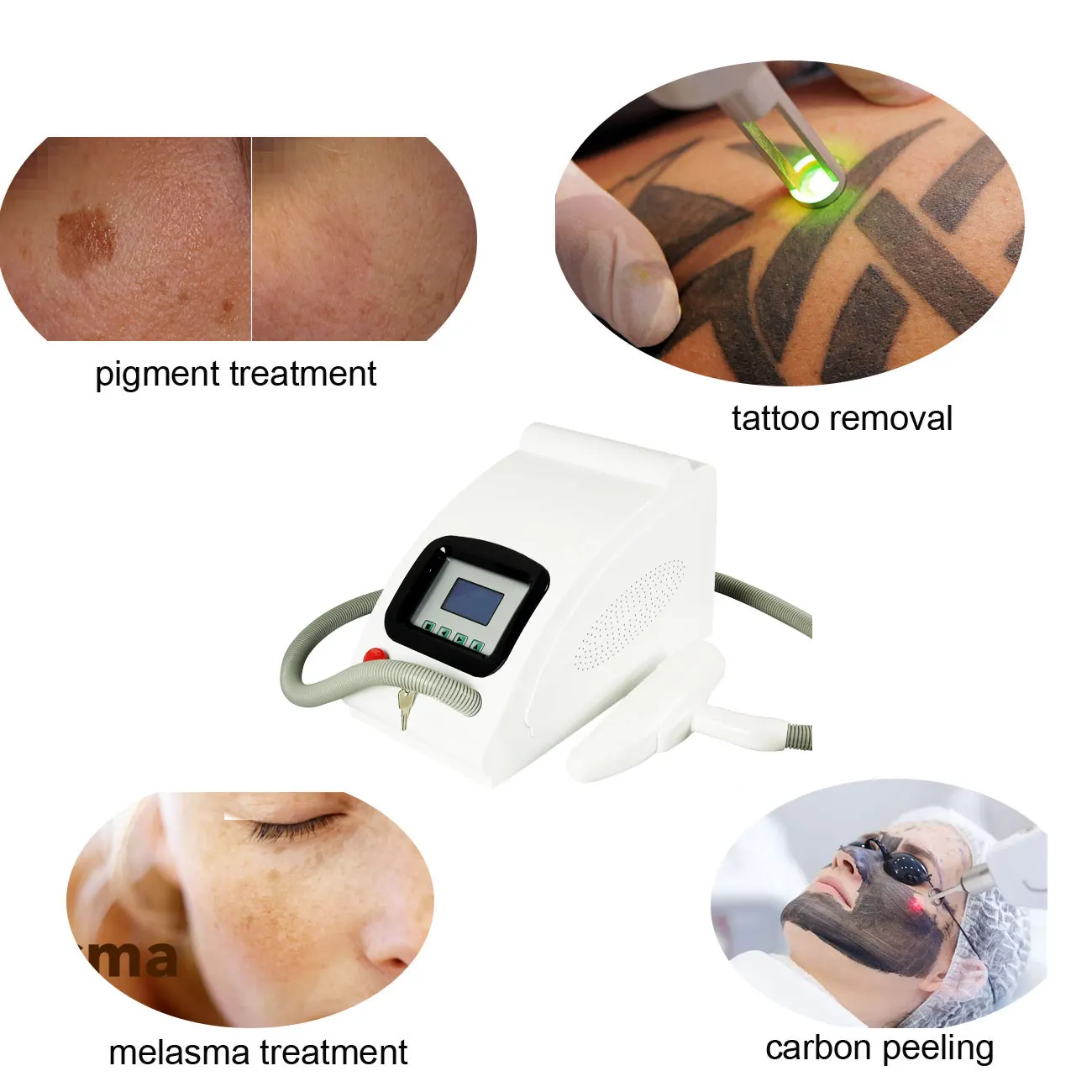 1320nm Carbon Facial Peeling Yag Laser Machine Buy Carbon Facial