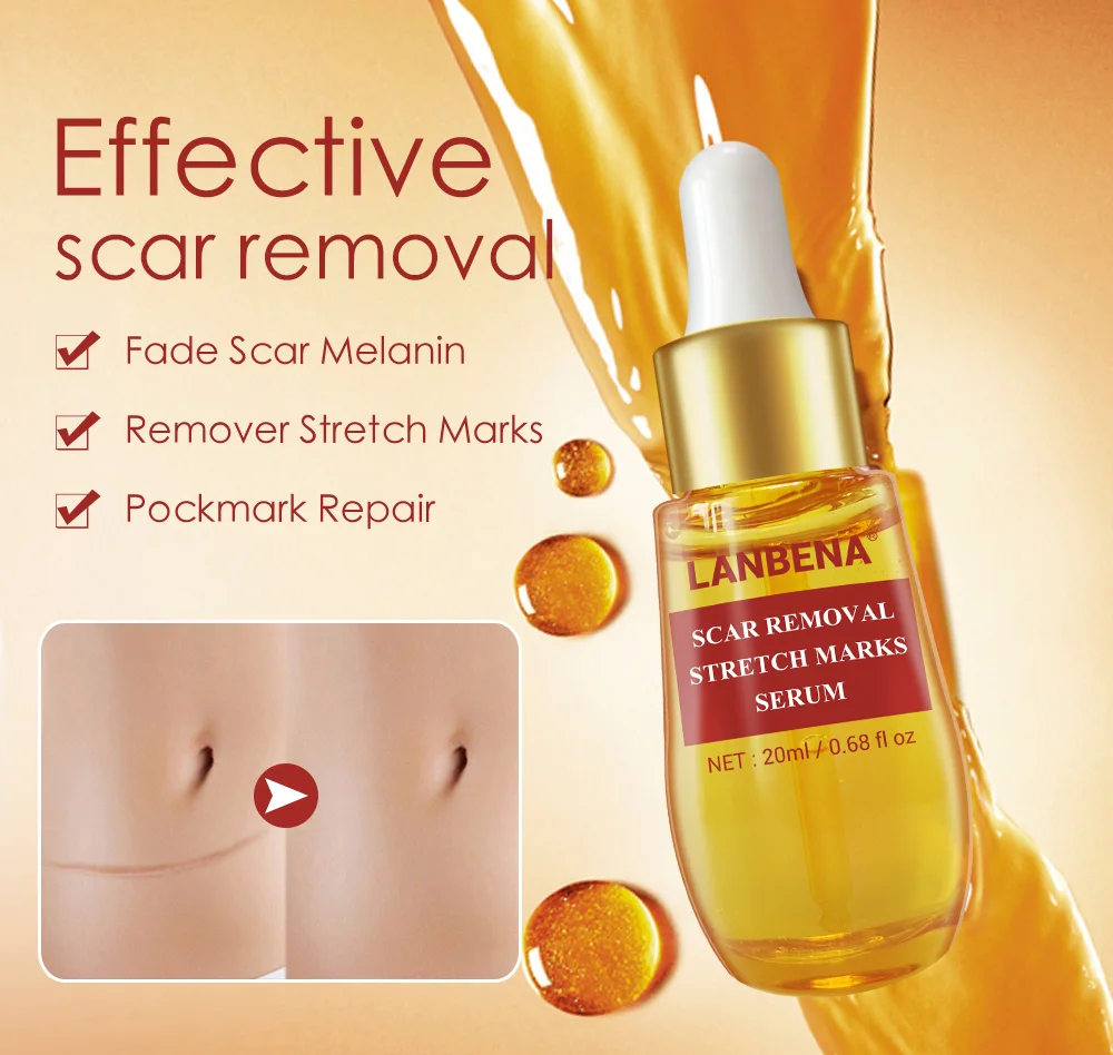 stretch mark serum
