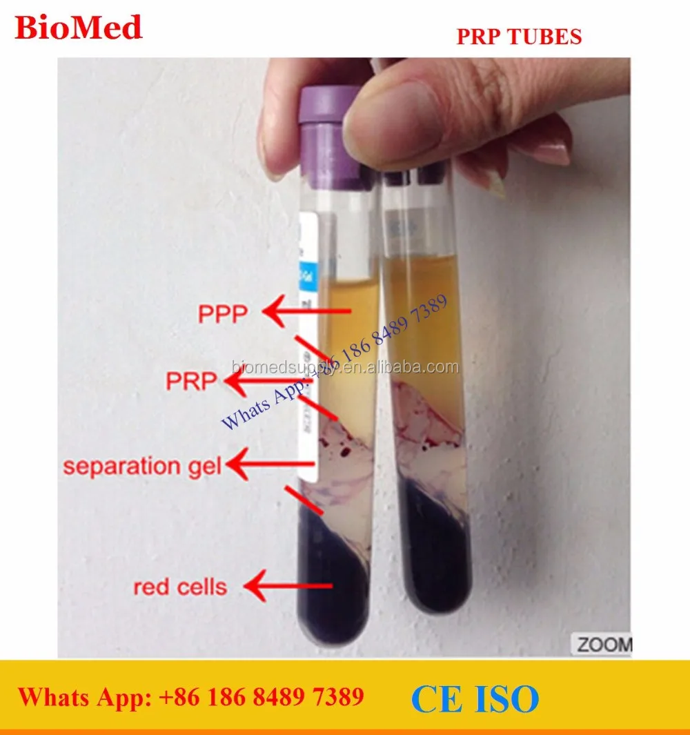 prp 8ml with anticoagulant and separation gel_