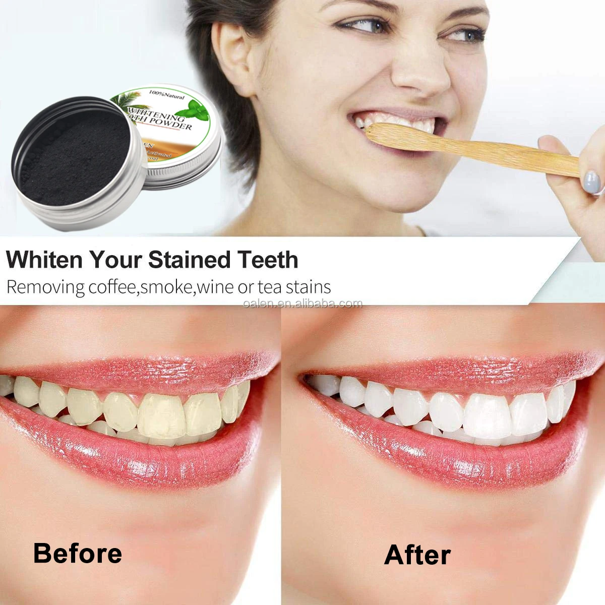 teeth whitening 15g.jpg