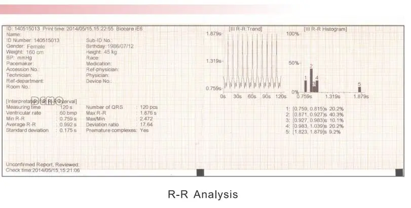 Touch screen digital 6-channel ECG machine
