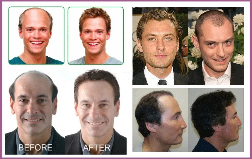 grosshandel indische haar manner toupet spitze auf top und vor naturliche welle schwarz mix weiss haar manner toupets fur schwarz manner buy