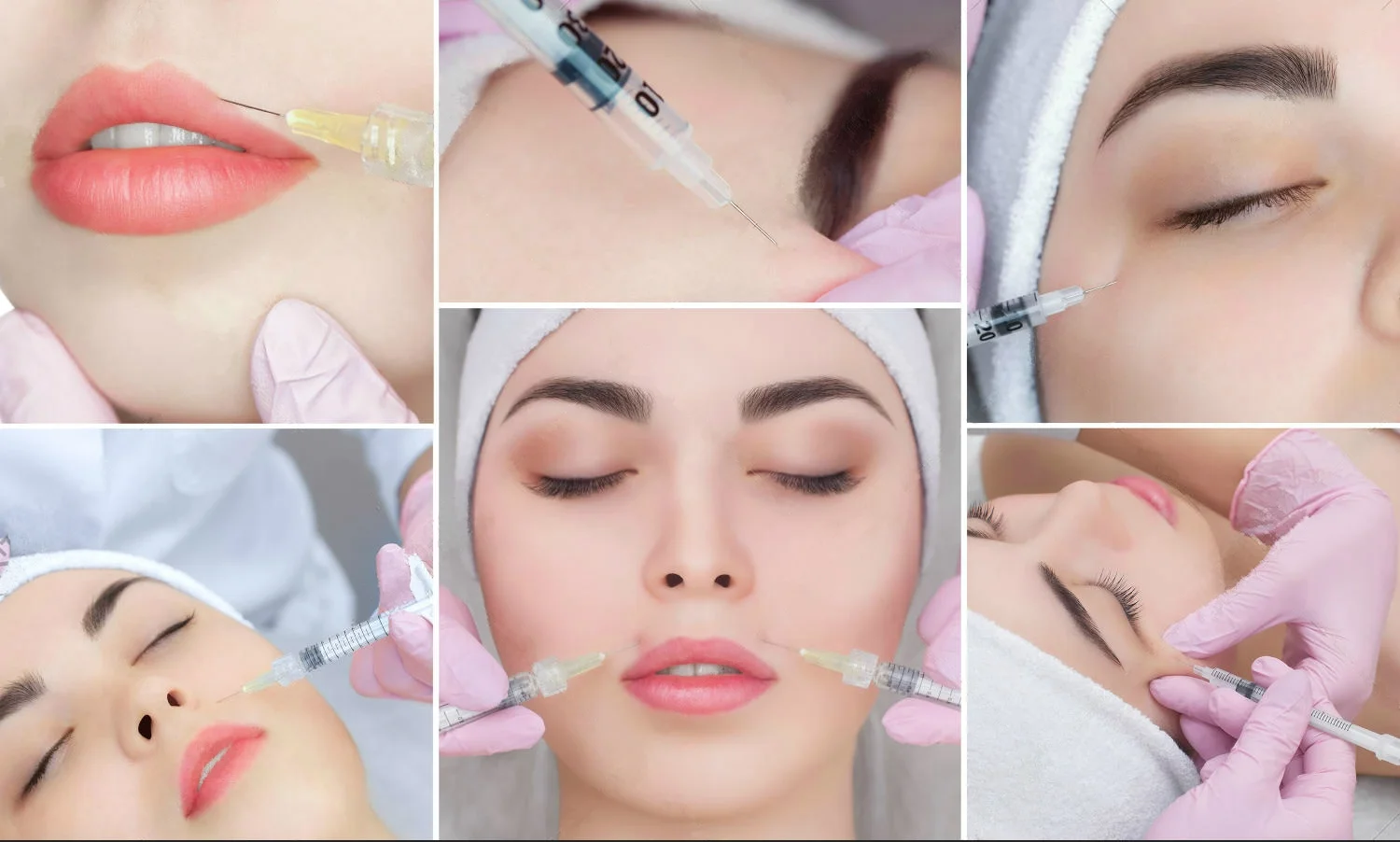 irenice filorga hyaluronic acid injectable dermal f