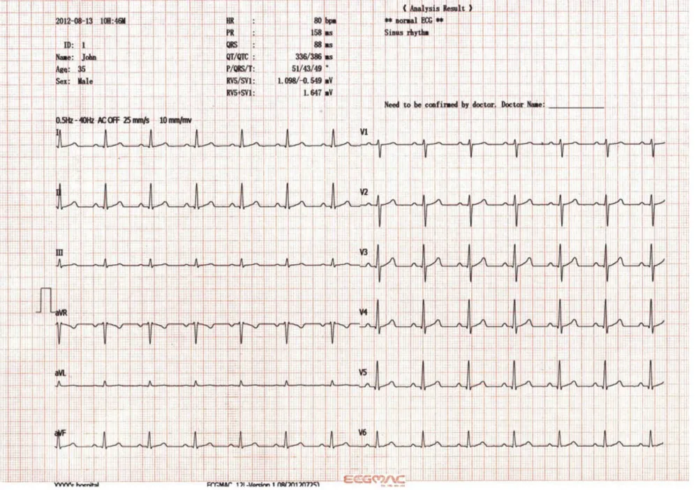 Professional Digital 12 Channel Ecg Machine With Ce Mark And Support ...