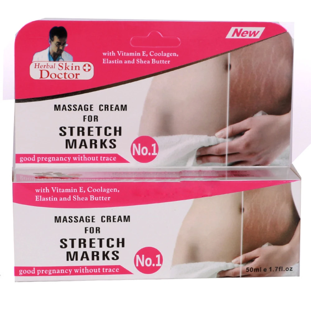 fat stretch marks removal cream