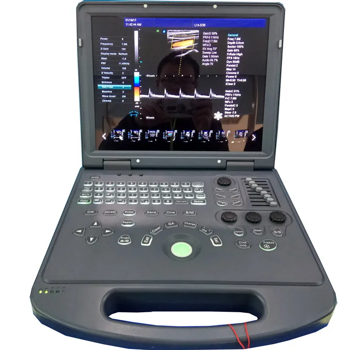 Portable medical equipment mobile computer ultrasound machine with all kinds of probe in hosital