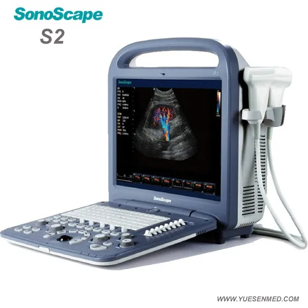 SonoScape ultrasound