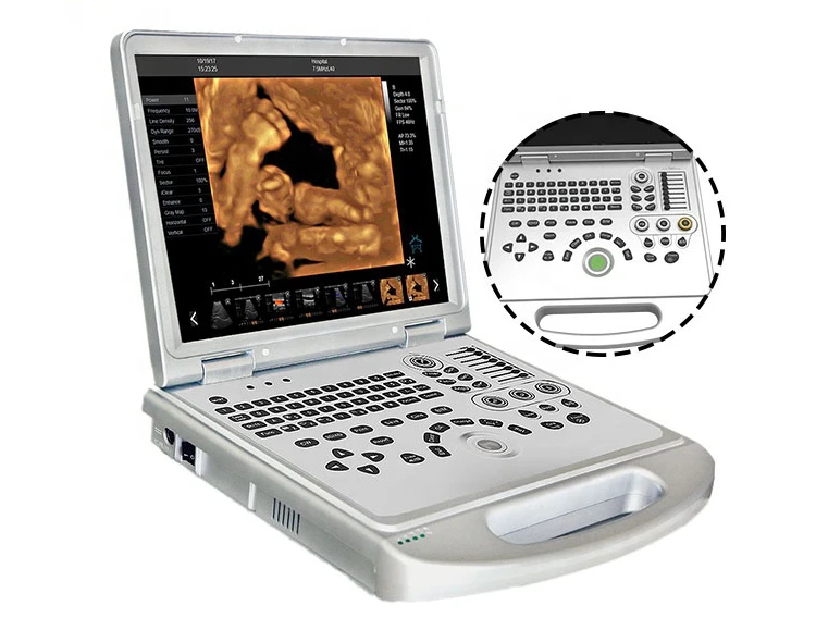 Laptop Color Doppler Ultrasound Laptop Color Doppler Ultrasound