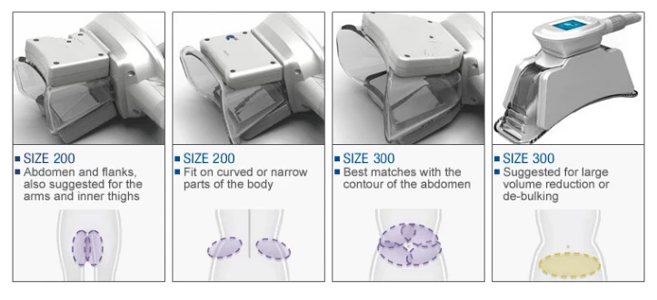 slimming cryolipolysis.jpg