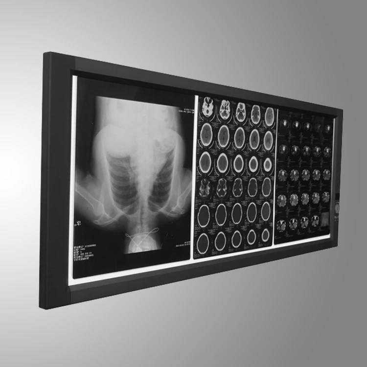 3 bay x ray display board flat led light
