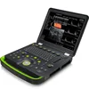 15inch LED Screen 3d/4d Laptop Ultrasonic scanner with Daul Probes for laptop computer