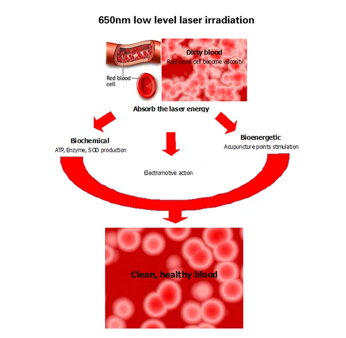 Onlineamericanstore Healthcare Laser Watch As A Gift For Parents Accessories -Online American Store HTB1UvXKMXXXXXbnXFXX760XFXXXn