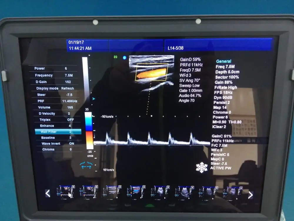 Doppler Ultrasound Equipment Type 3D/4D Portable Color Doppler Ultrasound System