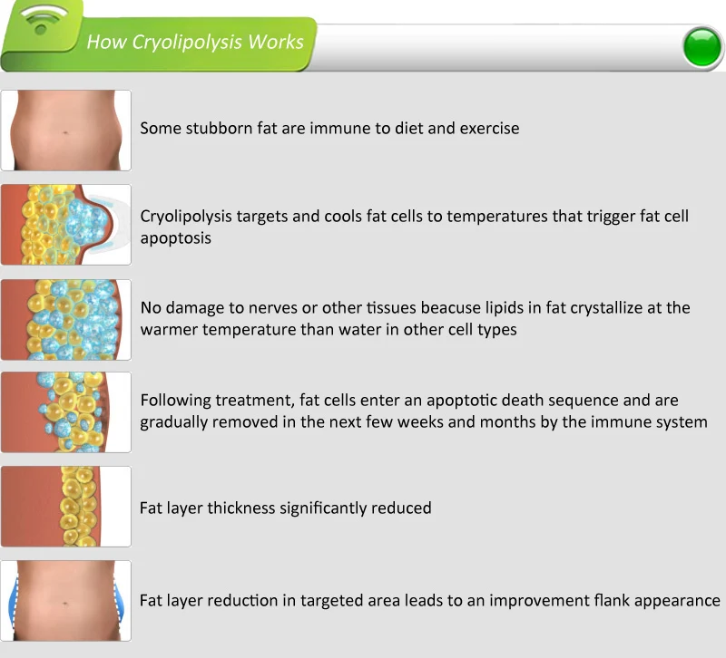 Portable doulbe cryolipolysis handle cool sculpture cryolipolysis body coolsculpting cost/coolsculpting price/coolsculpting reviews/cryo freeze fat/