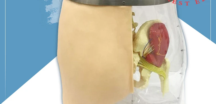 2 Injection model.jpg