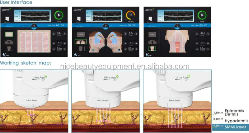 Promotion! Ds 13mm Hifu Cartridge For Beco Fu4.5-2s,Fu4.5-4s,Fu4.5-5s