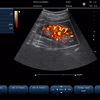 New Portable Echocardiography Ultrasound Scanner With Cheaper Price Than Ge Mindray Sonoscape Ultrasound System