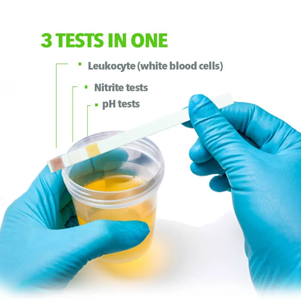 Iso Fda Ce Approved One Touch Accurate Urine Test Strips Uti,Urs-3n,Leukocytes,Nitrite,Ph Strips ...