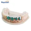 Keyscien XYZ Dental 3D Printer Printing Prototype Customer Service