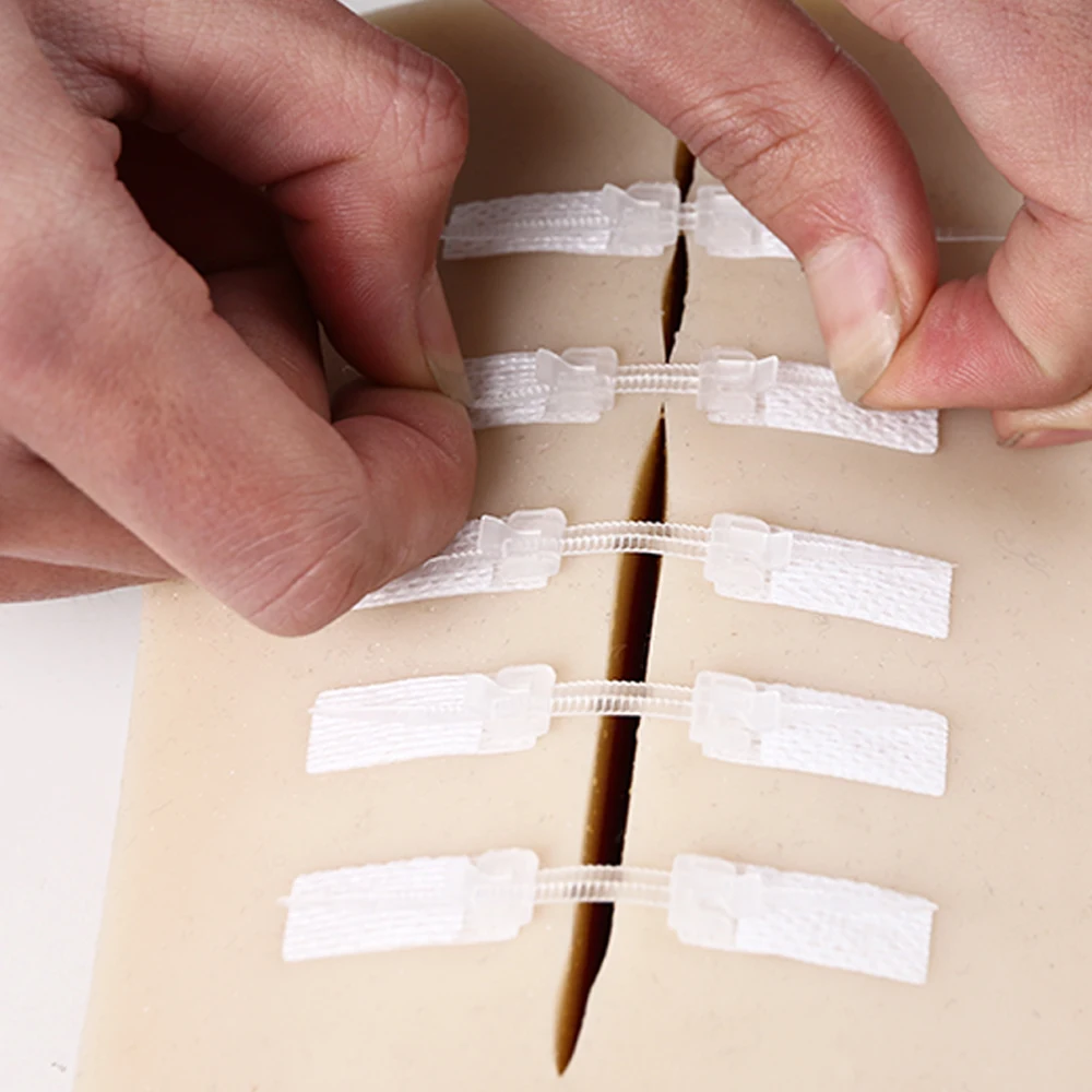 
skin stretching and secure wound closure system without stitches 